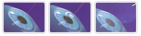 ÀÎÆ®¶ó ¶ó½Ä
